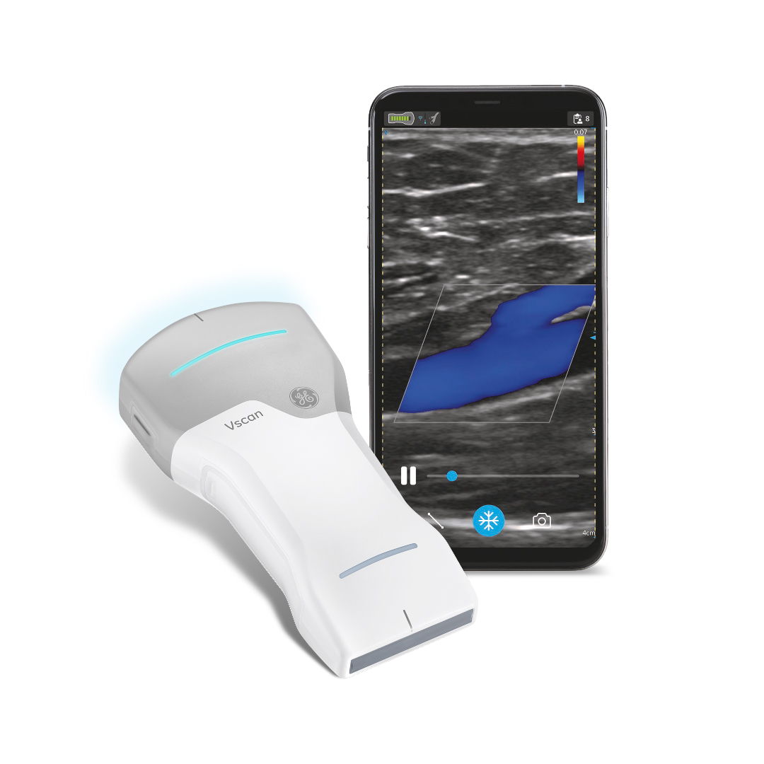Ecografo palmare wireless con smartphone (non incluso nella configurazione di vendita).
